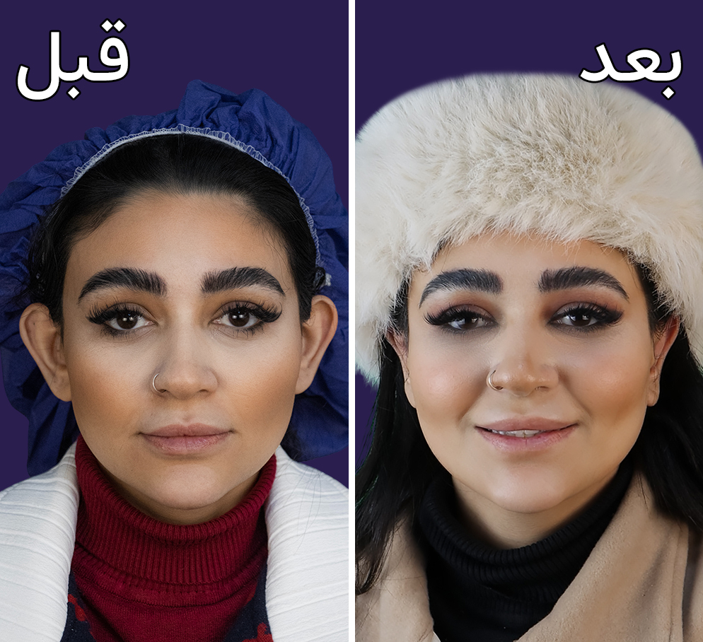 عمل اتوپلاستی گوش در مجموعه دکتر ساعدی