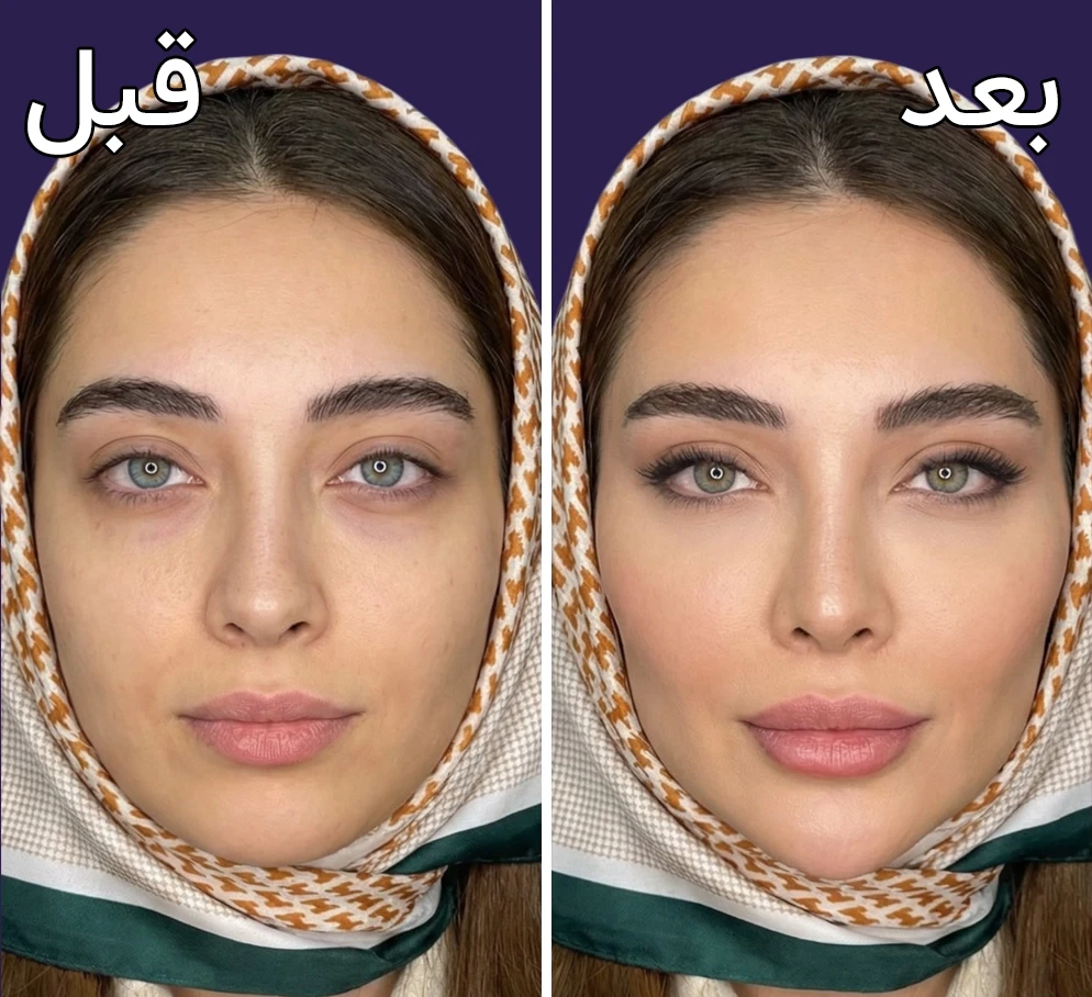 قبل و بعد کانتورینگ صورت